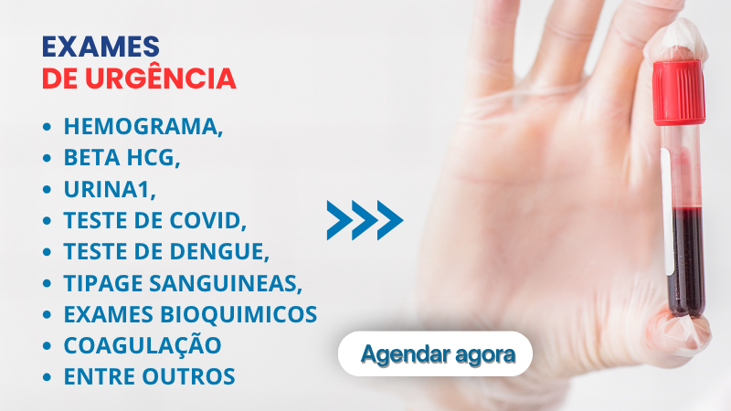 exames de urgencia em cotia resultado em 2h aqui você realizada os principais exames como Hemograma, Beta HCG, Urina1, Teste de Covid, Teste de Dengue, Tipagem Sanguineas, Exames Bioquimicos e Coagulação.